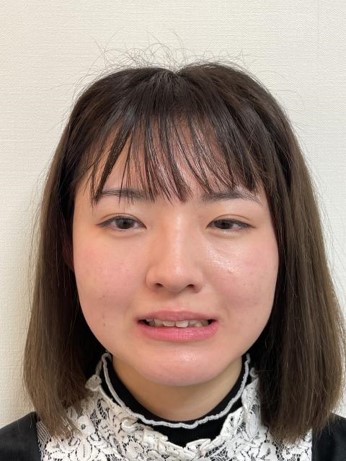 非抜歯矯正で口元の形とスマイルラインの改善